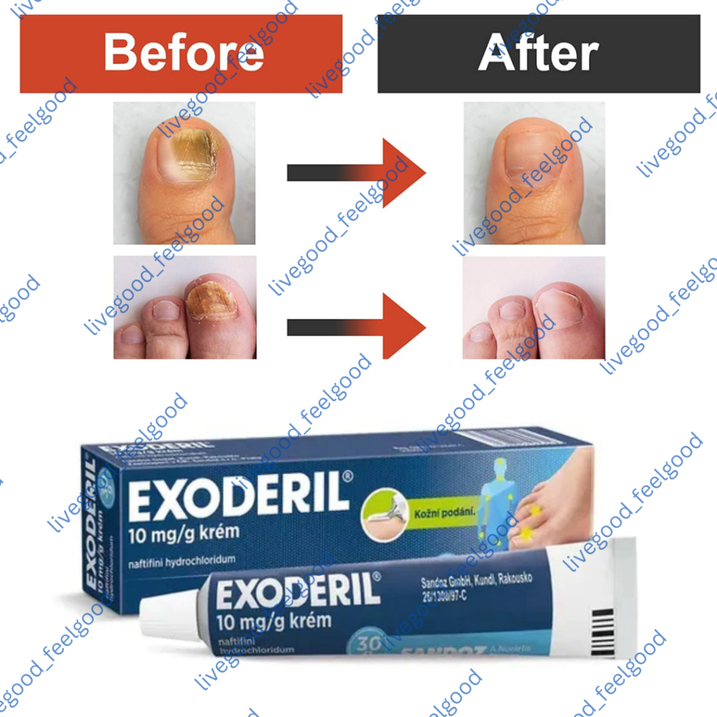Ex-Lovir % 1 Krem 2 G 1 Ex Lovir 1 Krem 2 G 29735